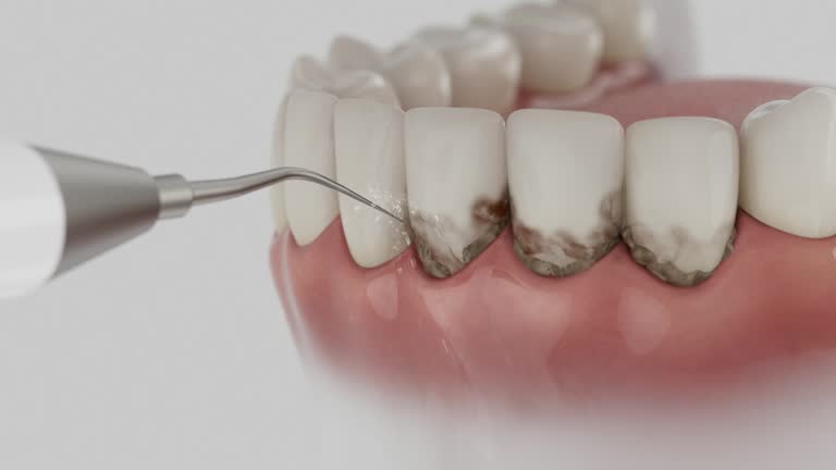 Reliable Root Canal Treatment contractor in Pender County County, NC by Dentist Open Now